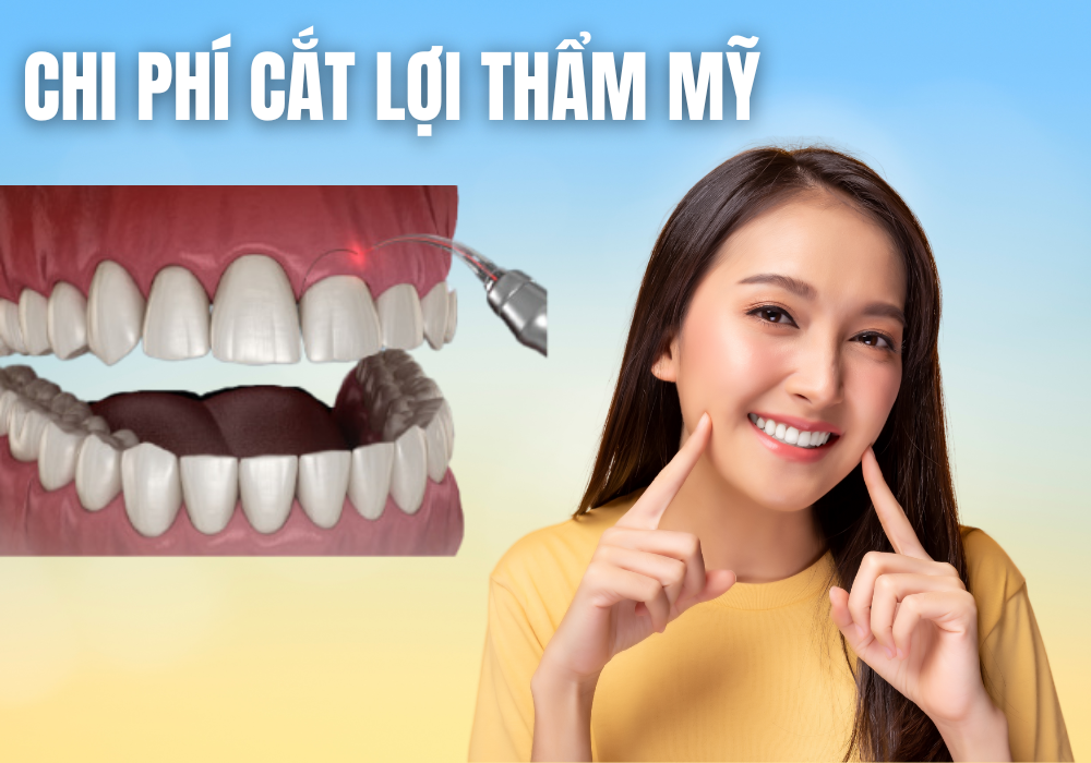 Chi phí cắt lợi thẩm mỹ không đơn thuần là để làm đẹp, mà còn góp phần bảo vệ sức khỏe lâu dài Chi phí cắt lợi thẩm mỹ không đơn thuần là để làm đẹp, mà còn góp phần bảo vệ sức khỏe lâu dài