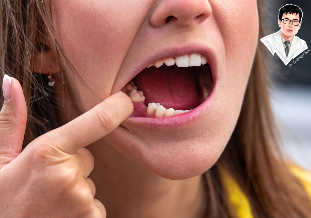 Kiểm tra vị trí mất răng trước khi cấy ghép implant – Bước quan trọng để chẩn đoán điều trị. Kiểm tra vị trí mất răng trước khi cấy ghép implant – Bước quan trọng để chẩn đoán điều trị.