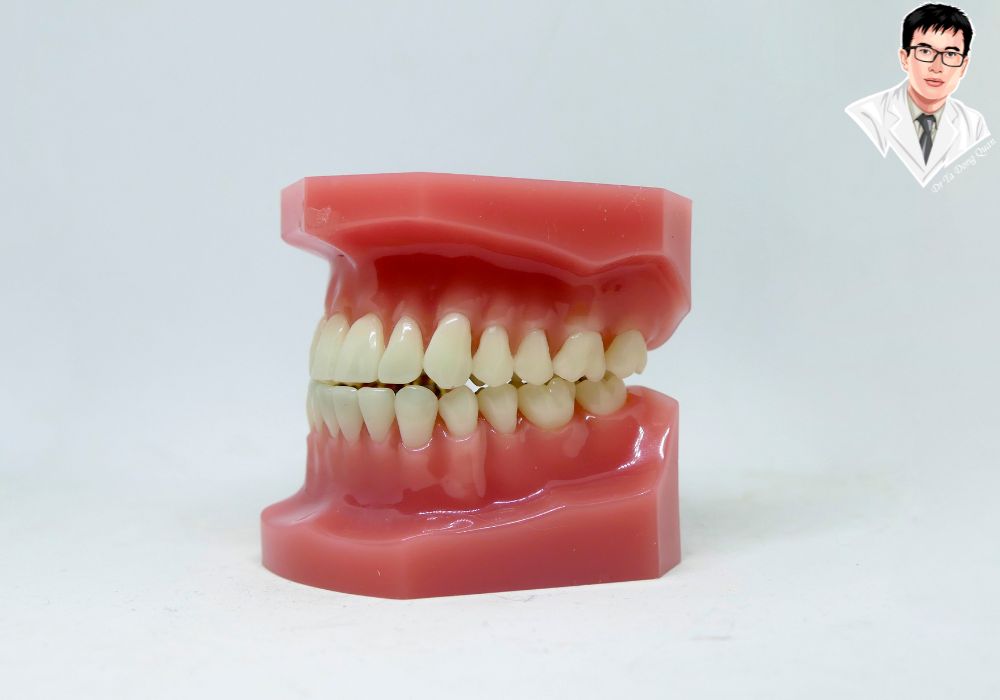 Cấu trúc răng và nướu chuẩn đẹp sau phẫu thuật cắt lợi thẩm mỹ giúp tăng tính thẩm mỹ và bảo vệ sức khỏe răng miệng. Cấu trúc răng và nướu chuẩn đẹp sau phẫu thuật cắt lợi thẩm mỹ giúp tăng tính thẩm mỹ và bảo vệ sức khỏe răng miệng.