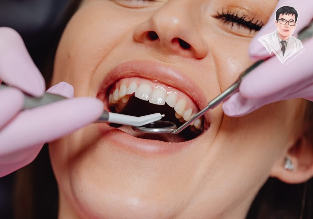 Hình ảnh bác sĩ nha khoa đang kiểm tra khoang miệng cho bệnh nhân sau khi nhổ răng, chuẩn bị đánh giá điều kiện trồng Implant đúng thời điểm.