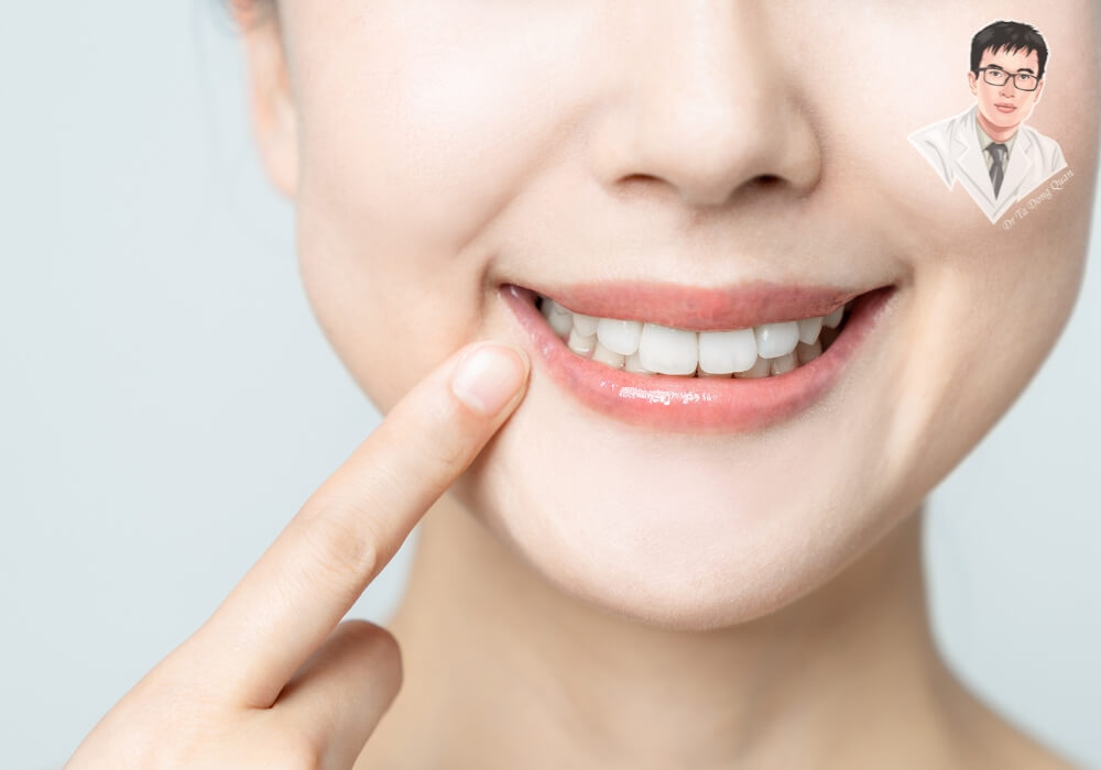 Nụ cười tươi tắn của người phụ nữ sau khi làm răng implant, hàm răng đều đặn, trắng sáng tự nhiên, thể hiện sự tự tin và hài lòng.