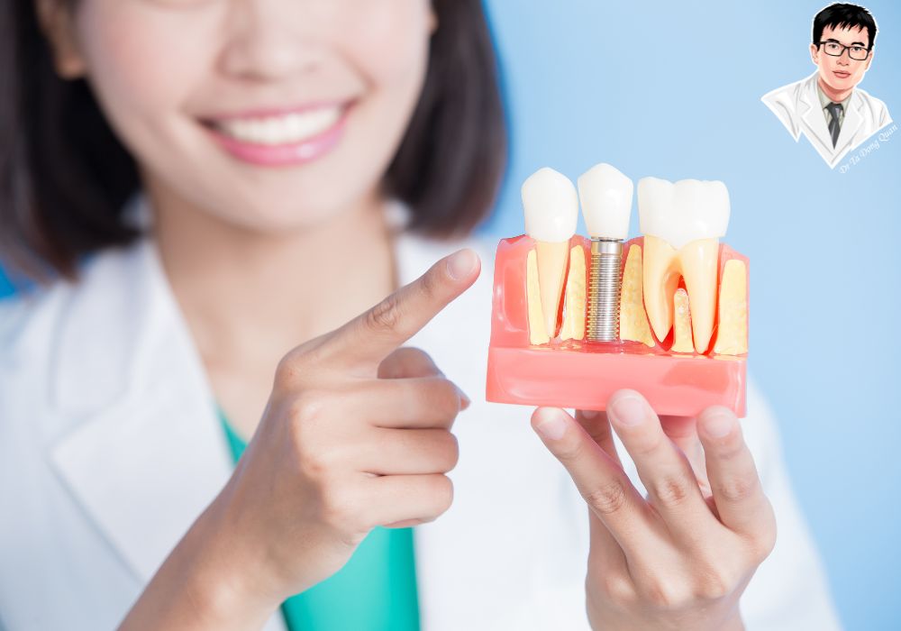 Kiểm tra vị trí implant – Đảm bảo thời gian phục hồi đúng tiến độ và an toàn. Kiểm tra vị trí implant – Đảm bảo thời gian phục hồi đúng tiến độ và an toàn.