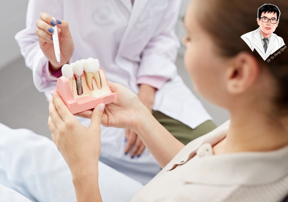 Tư vấn giúp bệnh nhân hiểu rõ quy trình cấy implant và các lựa chọn trụ phù hợp Tư vấn giúp bệnh nhân hiểu rõ quy trình cấy implant và các lựa chọn trụ phù hợp